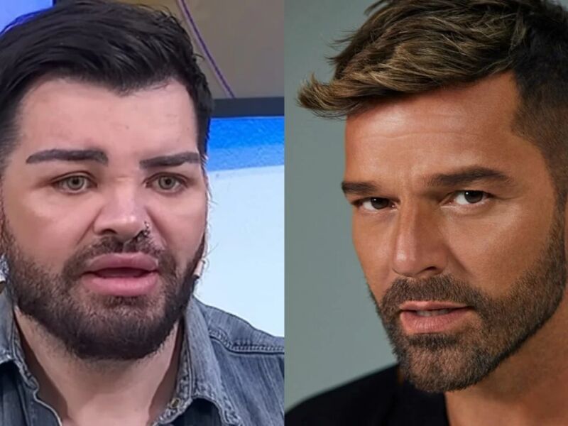 Argentino faz mais de 30 plásticas para se parecer Ricky Martin