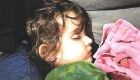 Sophia de Jesus Ocampo, de 2 anos, já fragilizada  