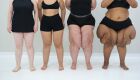 JD1TV: Mês de conscientização do lipedema chama atenção para doença pouco diagnosticada