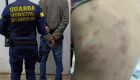 Lesões nas costas da vítima