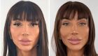 Maya Massafera muda cor dos olhos com cirurgia