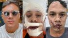 Personal trainer é espancado ao defender mulheres que estavam sendo importunadas sexualmente