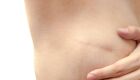 Foto: iStock