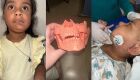 Menina passou por procedimento inovador