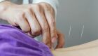 A profiss&atilde;o de acupunturista est&aacute; regulamentada no Brasil