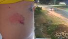 Homem foi agredido no meio da rua