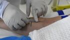 MS não registra casos confirmados de hantavirose desde 2019