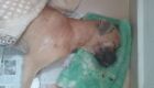 Boxer sobrevivente de local de desova de animais está em estado grave