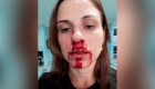Mulher é agredida pelo ex-marido e publica foto com rosto ensanguentado