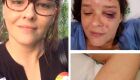 Em Recife, mulher é agredida e ameaçada em bar por usar adesivo dea Ciro Gomes