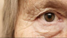 A degeneração macular relacionada a idade e leva à perda da visão central