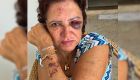 Ex-primeira dama é agredida por assaltantes enquanto rezava