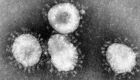 Amostra laboratorial do coronavírus, identificado 1º na China