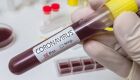 Com 33 casos suspeitos, SES confirma mais dois casos de coronavírus em MS