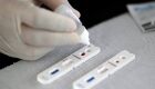 Testes de coronavírus irão para 71 unidades de saúde da capital