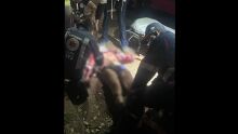 Jovem é atacado por três pitbulls, tem orelha dilacerada e artéria atingida por mordidas