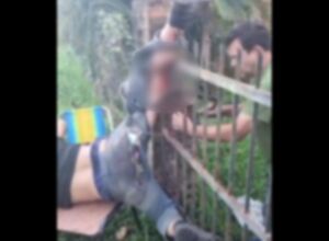 JD1TV: Bebâdo fica pendurado após grade de portão entrar na perna na fronteira
