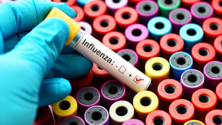 Vírus Influenza 