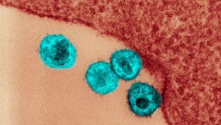 Micrografia eletrônica de transmissão do HIV