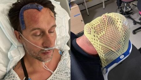 Homem descobre câncer após atribuir enxaquecas ao estresse da rotina