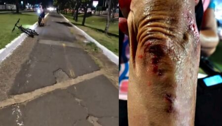 Ciclovia esburacada trouxe prejuízos para uma ciclista