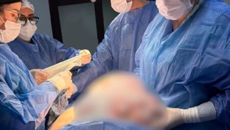 Tumor de 11 kg é retirado de paciente em cirurgia de alta complexidade na fronteira