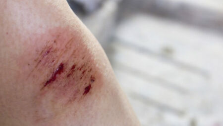 É o amor? Marido leva facadas de esposa, mas se nega a denunciá-la em Campo Grande