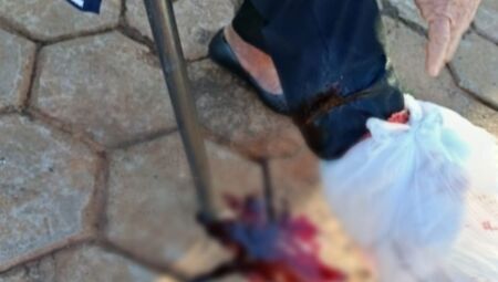 Idosa foi atacada na perna direita