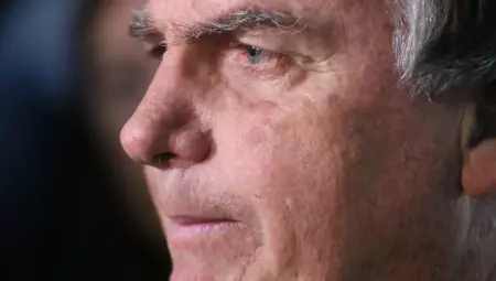 Este &eacute; o terceiro procedimento cir&uacute;rgico de Bolsonaro para bloquear o nervo fr&ecirc;nico e tentar conter as crises de solu&ccedil;os