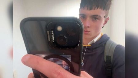 Vício em cigarro eletrônico faz adolescente perder pedaços do pulmão