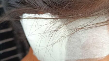 Mulher teve parte do membro arrancado "no dente" 