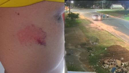 Homem foi agredido no meio da rua