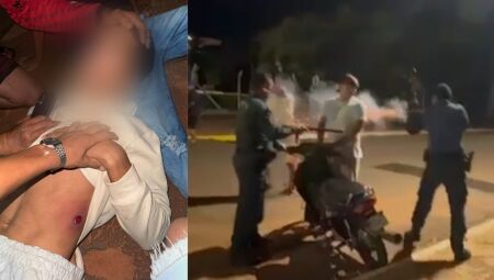 Jovem foi atingido por bala de borracha