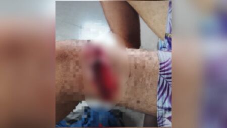 Trabalhador rural &eacute; resgatado por helic&oacute;ptero ap&oacute;s acidente com motosserra no Pantanal