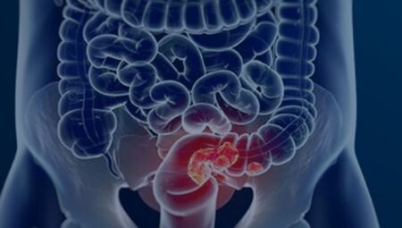 Diretriz vai passar por consulta p&uacute;blica e ser&aacute; analisada pela Conitec