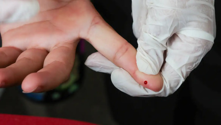 Teste r&aacute;pido para dengue