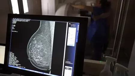 A medida tamb&eacute;m estende a folga para exames preventivos do HPV