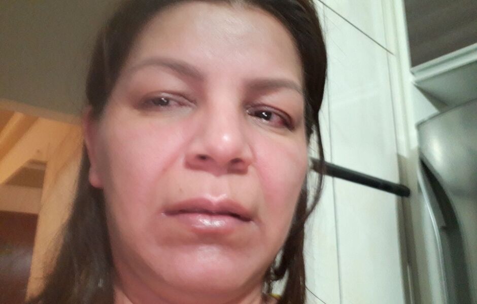 Aspecto físico e emocional de Verônica quando decidiu enfrentar a depressão e as demais doenças