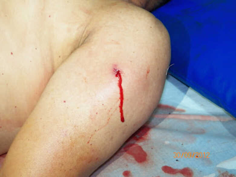 V&iacute;tima foi socorrida e levada ao hospital de Ponta Por&atilde;