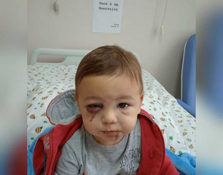 Menino de 1 ano e 8 meses foi levado em estado grave ao hospital, passou por cirurgia e, agora se recupera de ferimentos.