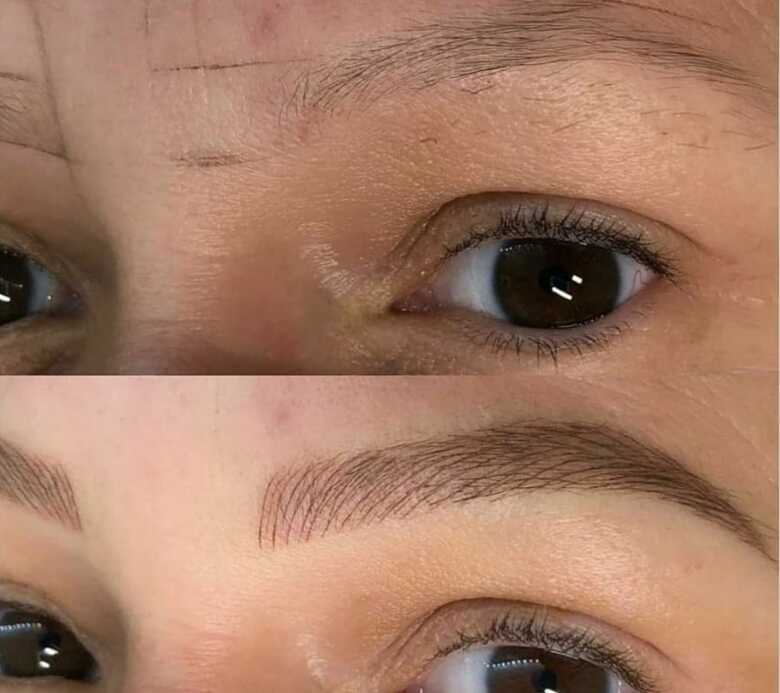 Est&uacute;dio tamb&eacute;m atende mulheres que sofrem com alopecias nas sobrancelhas