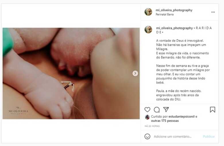 Fotógrafa registra parto de mãe que usava DIU: 'Milagre'