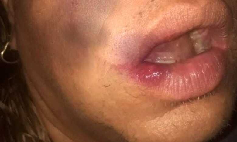 V&iacute;tima teve dois dentes quebrados e ficou com v&aacute;rios hematomas 