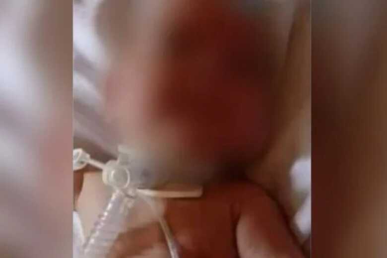 Imagens de bebê da reproduzidas da internet foram utilizados pelos criminosos