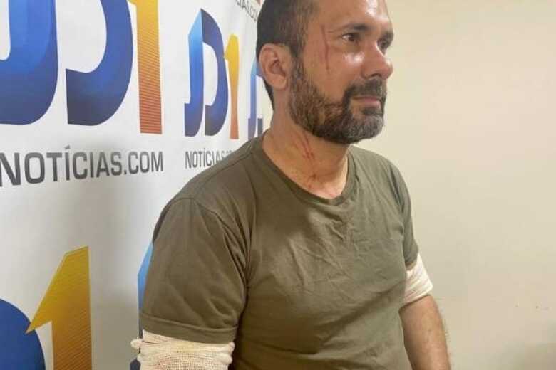 Saulo Batista durante entrevista ao JD1 Notícias; candidato tem marcas no rosto, peito e braços 