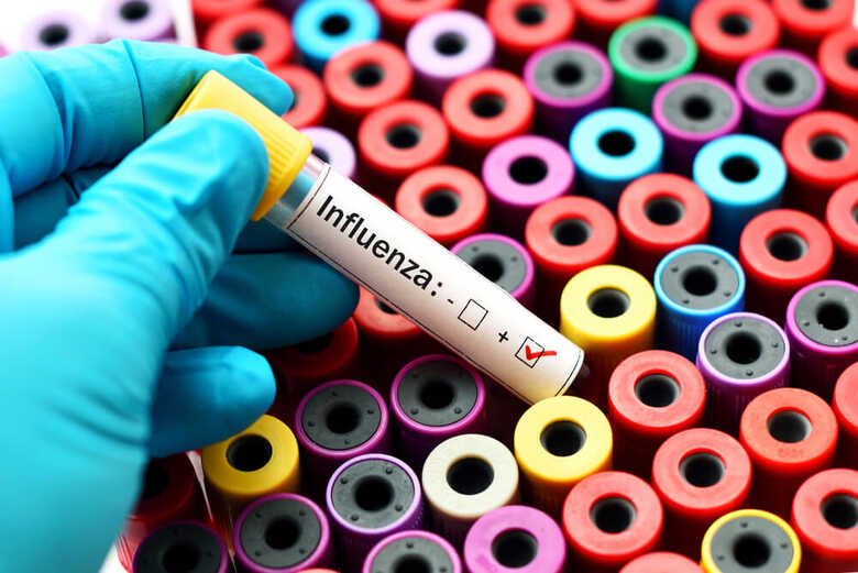 Vírus Influenza 
