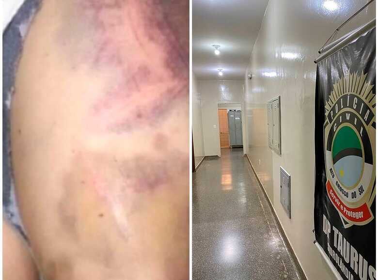 Caso aconteceu em Sidrolândia