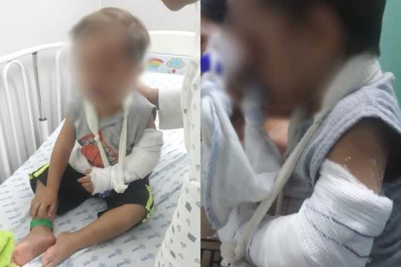 O menino precisou passar por cirurgia