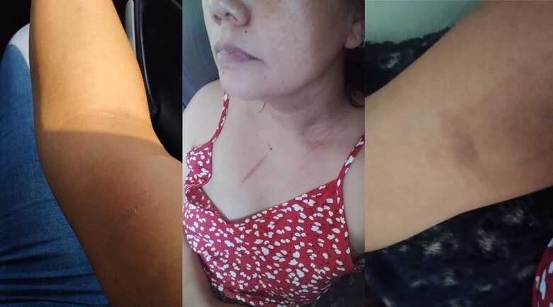 Vereadora publicou as les&otilde;es que ficaram em sua rede social