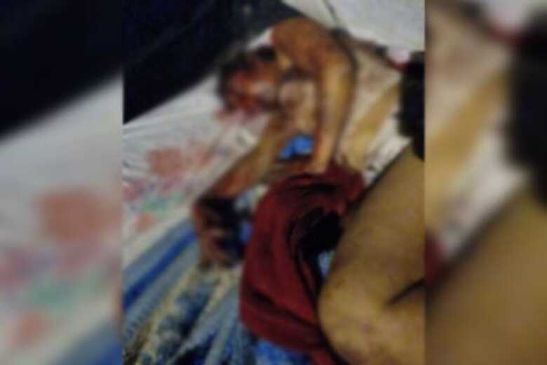Mayara está com o rosto completamente desfigurado